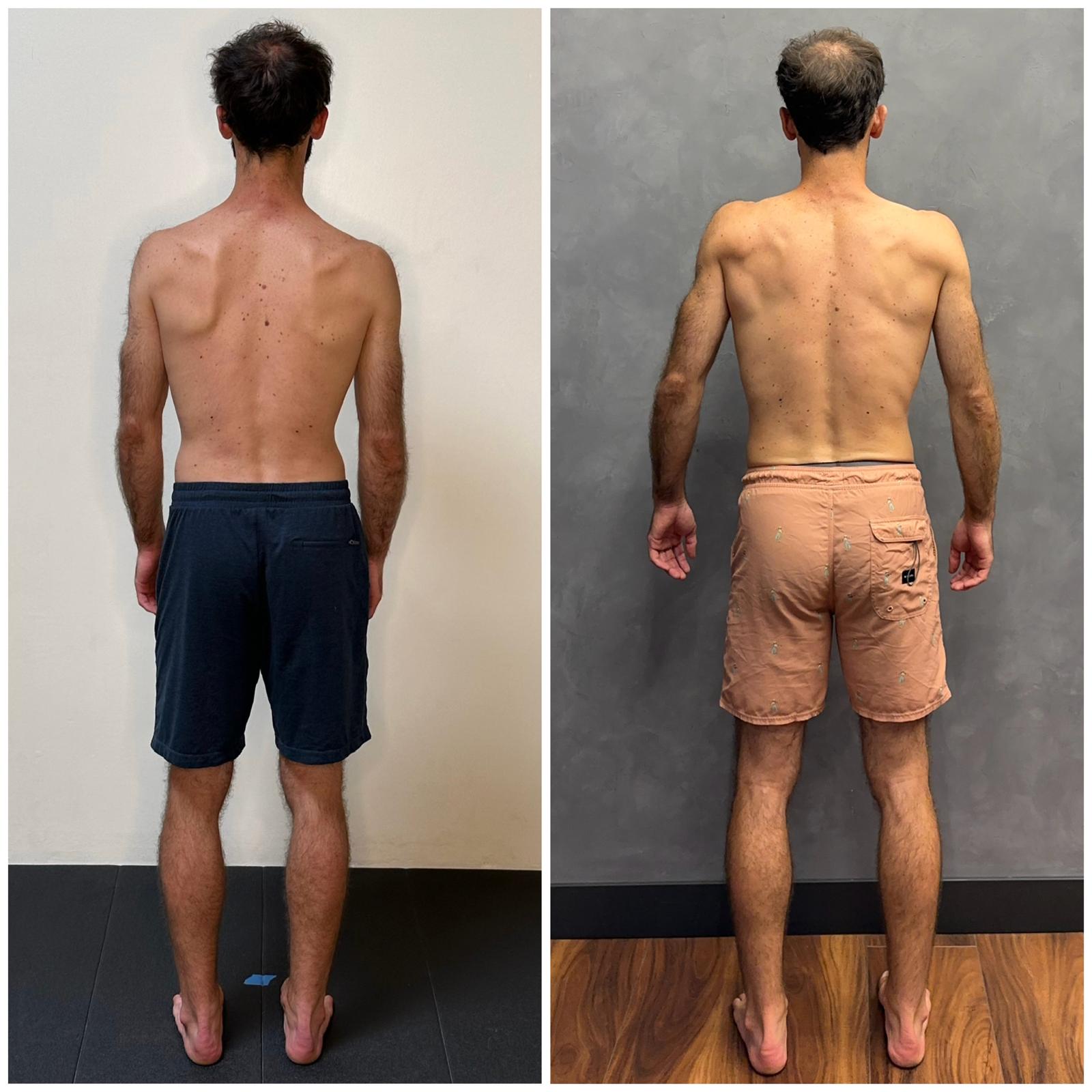 Viktor — back view, before and after Functional Patterns training
