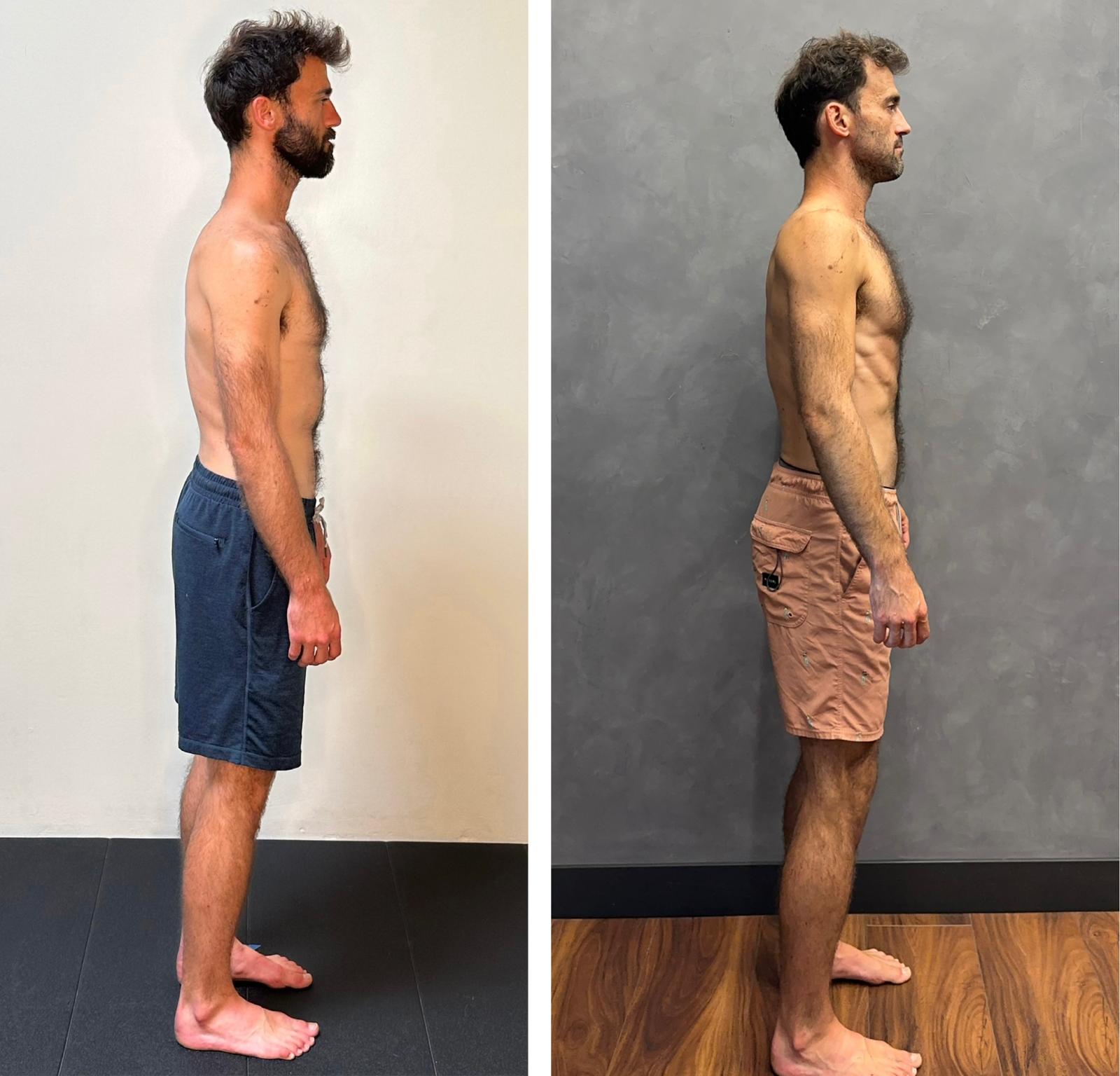 Viktor — side view, before and after Functional Patterns training